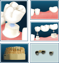 rehabilitacion_bucal